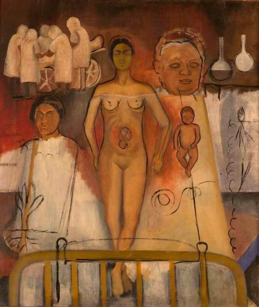 Frida et l’opération césarienne - Frida Kahlo image 1 reproduction de peinture à l’huile
