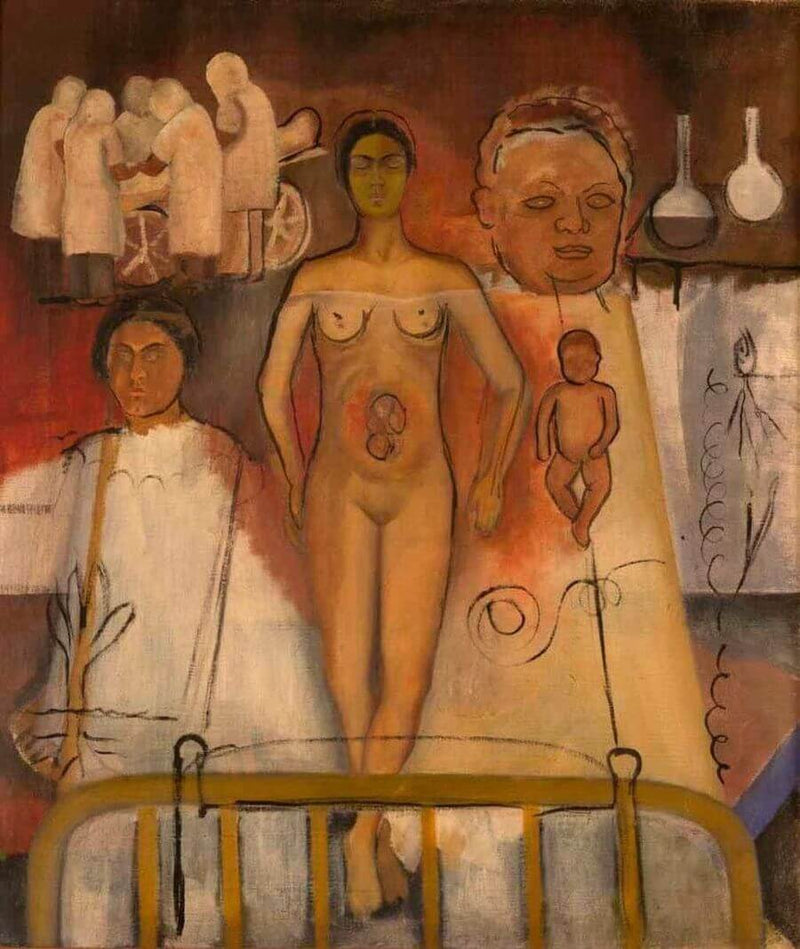 Frida et l’opération césarienne - Frida Kahlo
