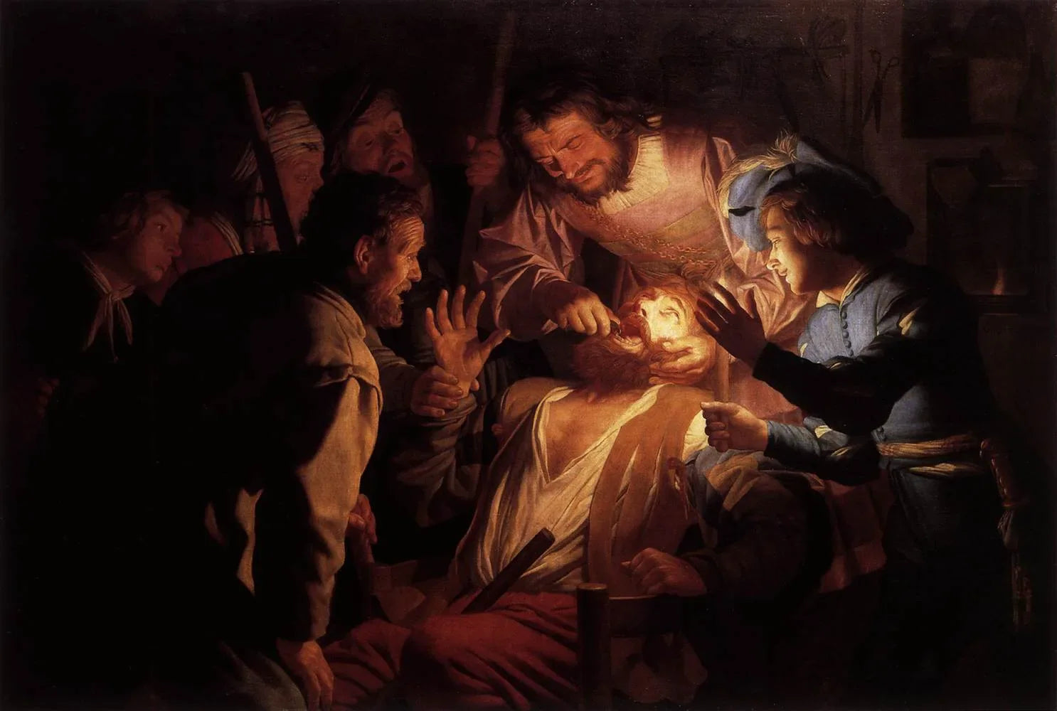 Le dentiste - Gerrit van Honthorst image 1 reproduction réalisée par Alpha Reproduction