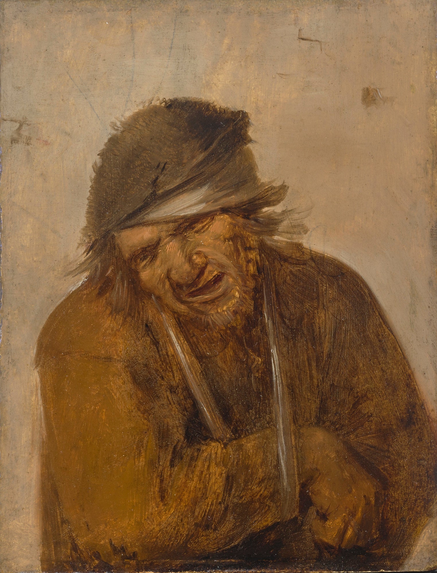 Un paysan grimaçant, le bras en écharpe - Adriaen Brouwer image 1 reproduction de peinture à l’huile